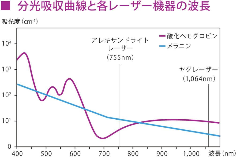分光吸収曲線と各レーザー機器の波長